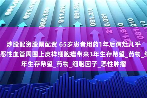 炒股配资股票配资 65岁患者用药1年后病灶几乎消失！西罗莫司为恶性血管周围上皮样细胞瘤带来3年生存希望_药物_细胞因子_恶性肿瘤